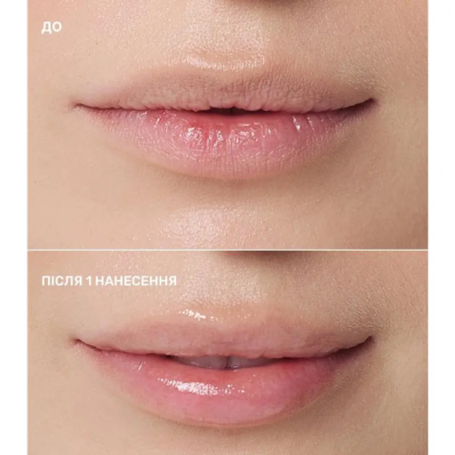 Блеск для губ LIPSS Balm Health & Recovery 10 мл